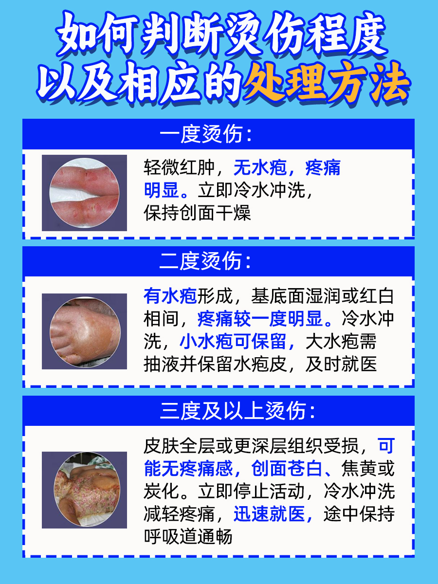 烫伤后正确处理法,守护肌肤安全  在日常生活中,烫伤是常见的意外伤害