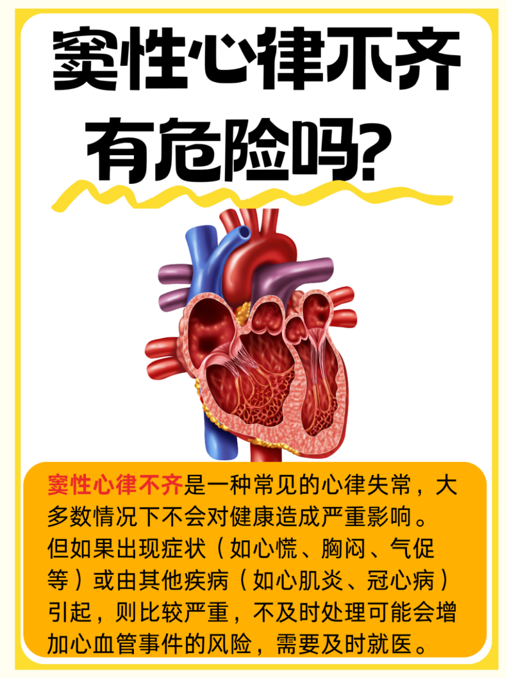 窦性心律不齐有危险吗 窦性心律不齐是一种常见的心律失常,指的是心脏