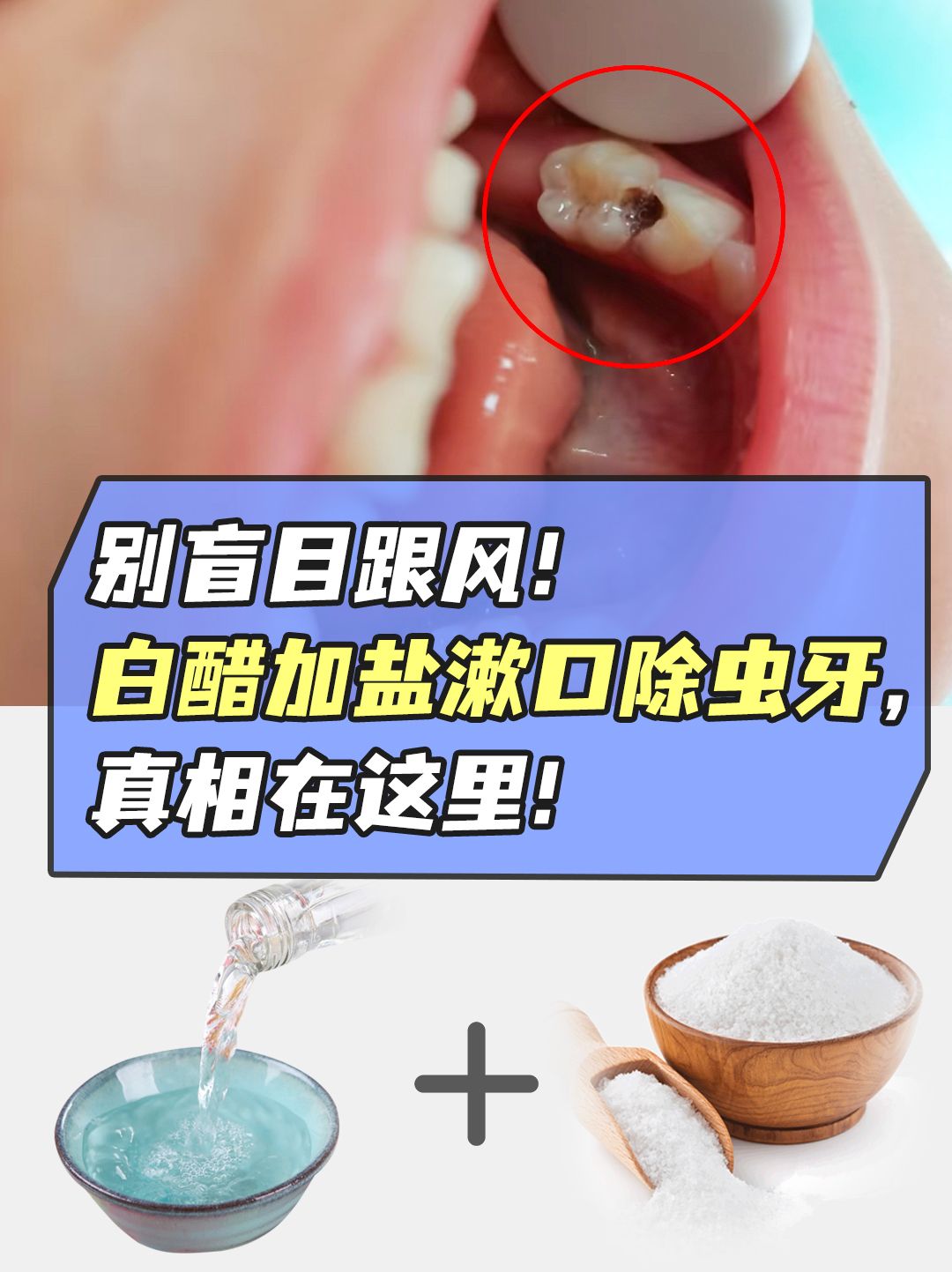 白醋加盐漱口除虫牙,真相看这里!