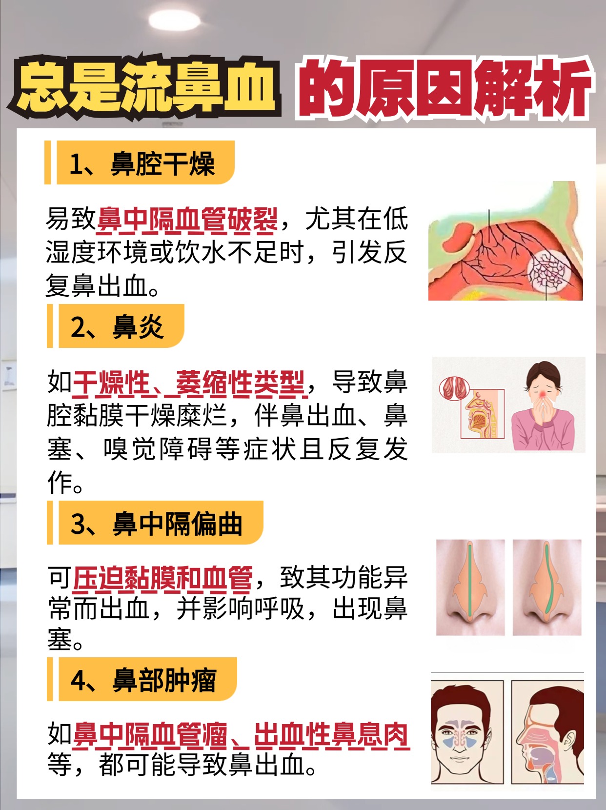 鼻子流血为什么眼睛也流血百科在线
