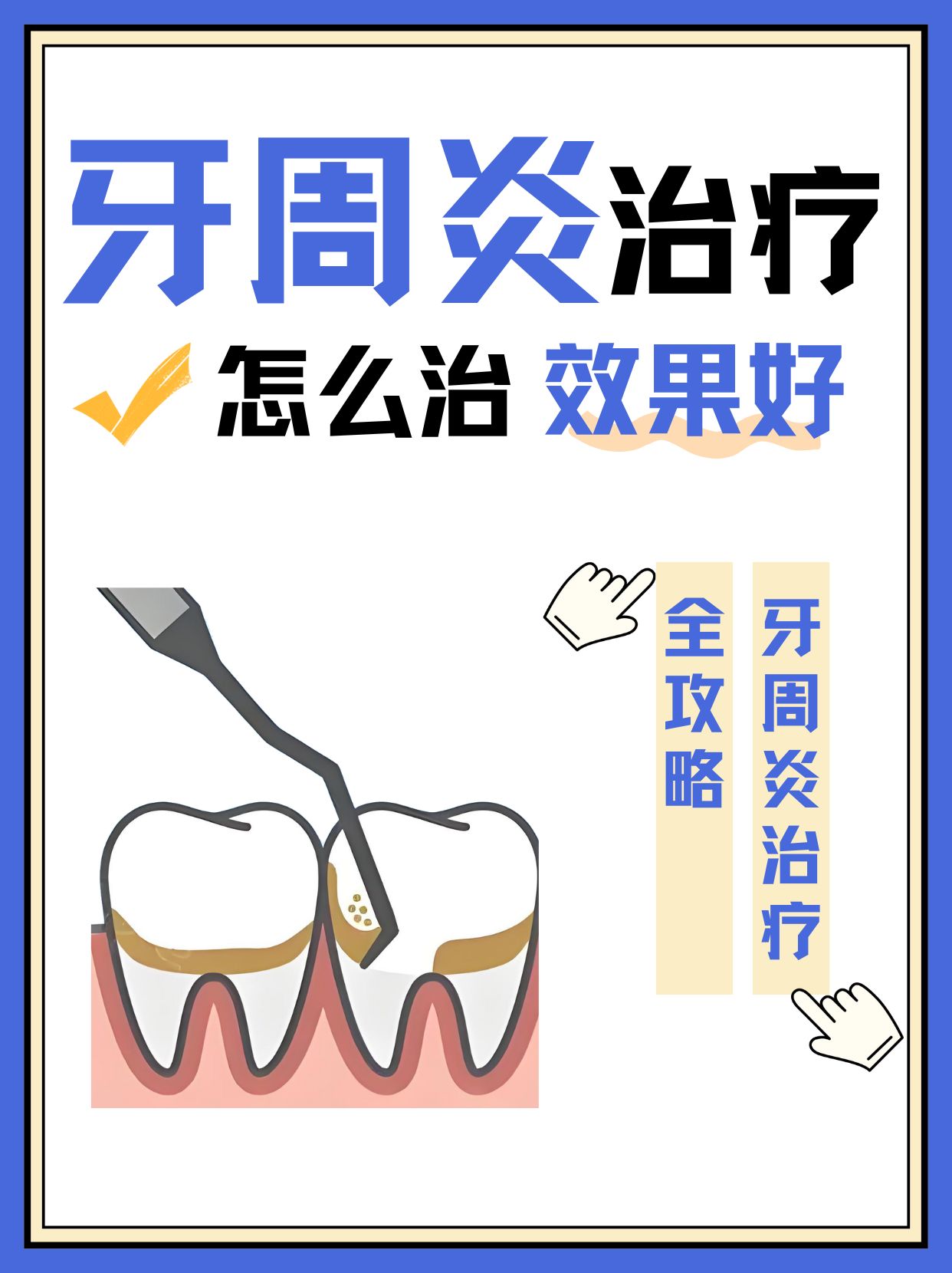 南京牙周炎怎么治疗效果好?