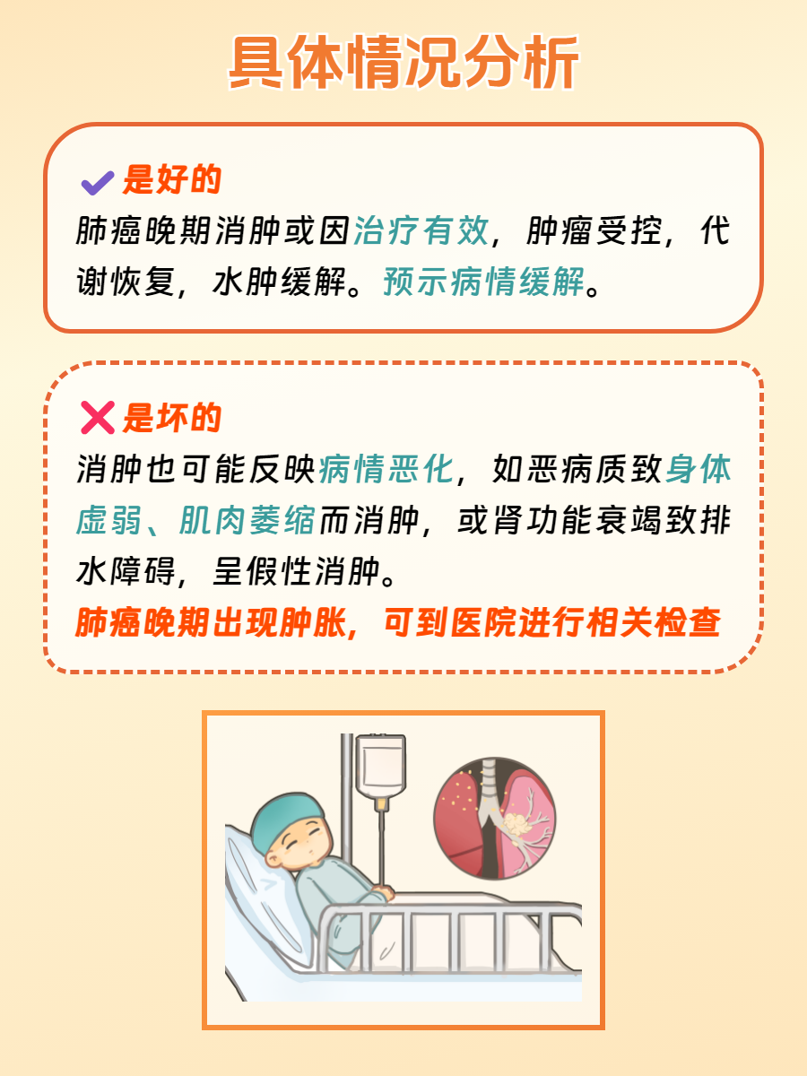 当肺癌发展到晚期,可能会出现各种症状,其中消肿是一个比较复阅的