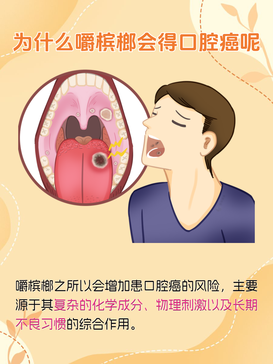 嚼槟榔口腔癌图片