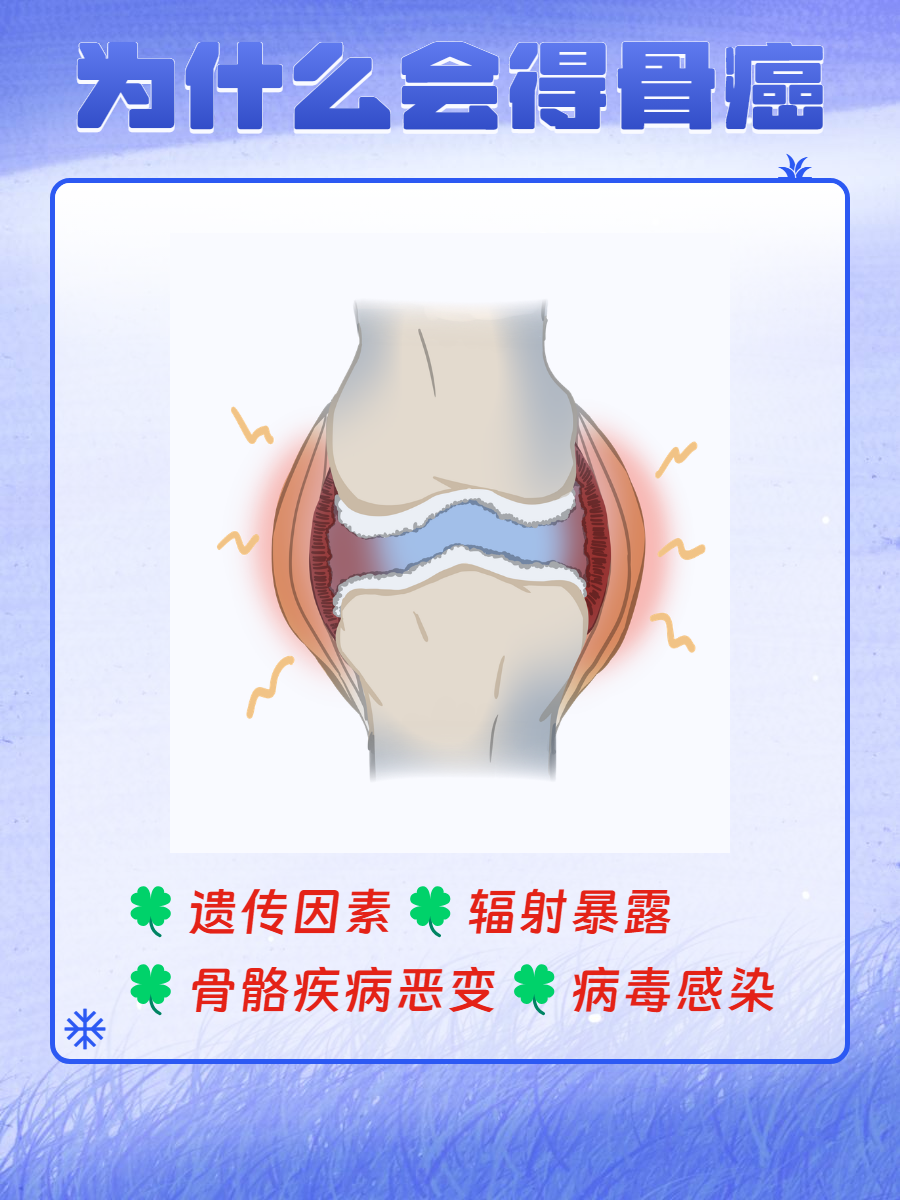 骨肿瘤卡通图片