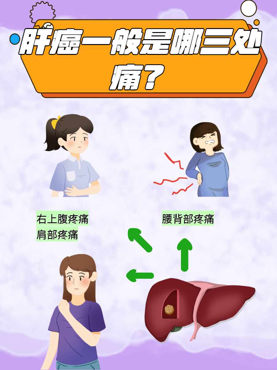 肝脏癌变疼痛部位大揭秘