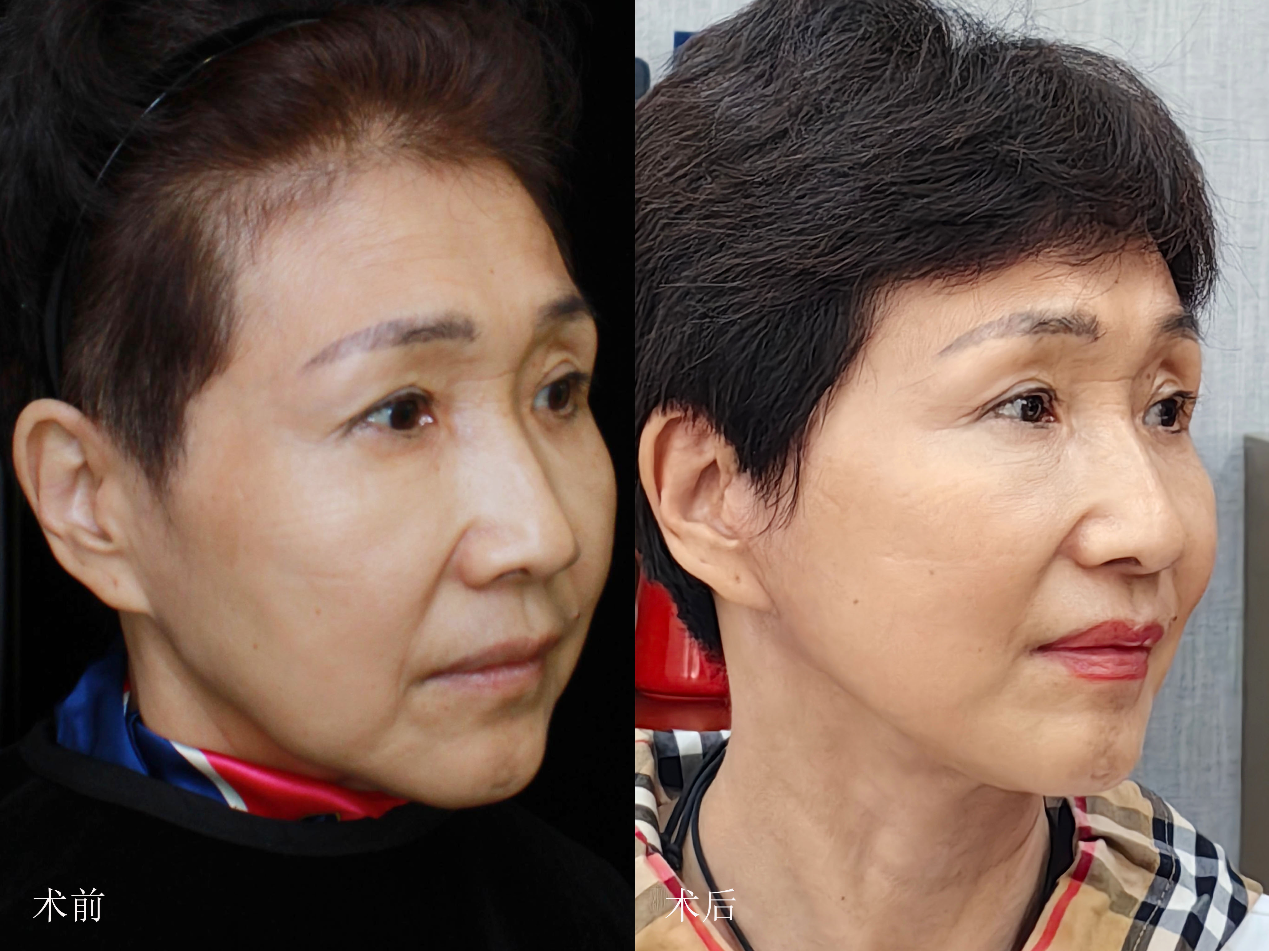 虽然已经50 ,但我依然有一万种可能~