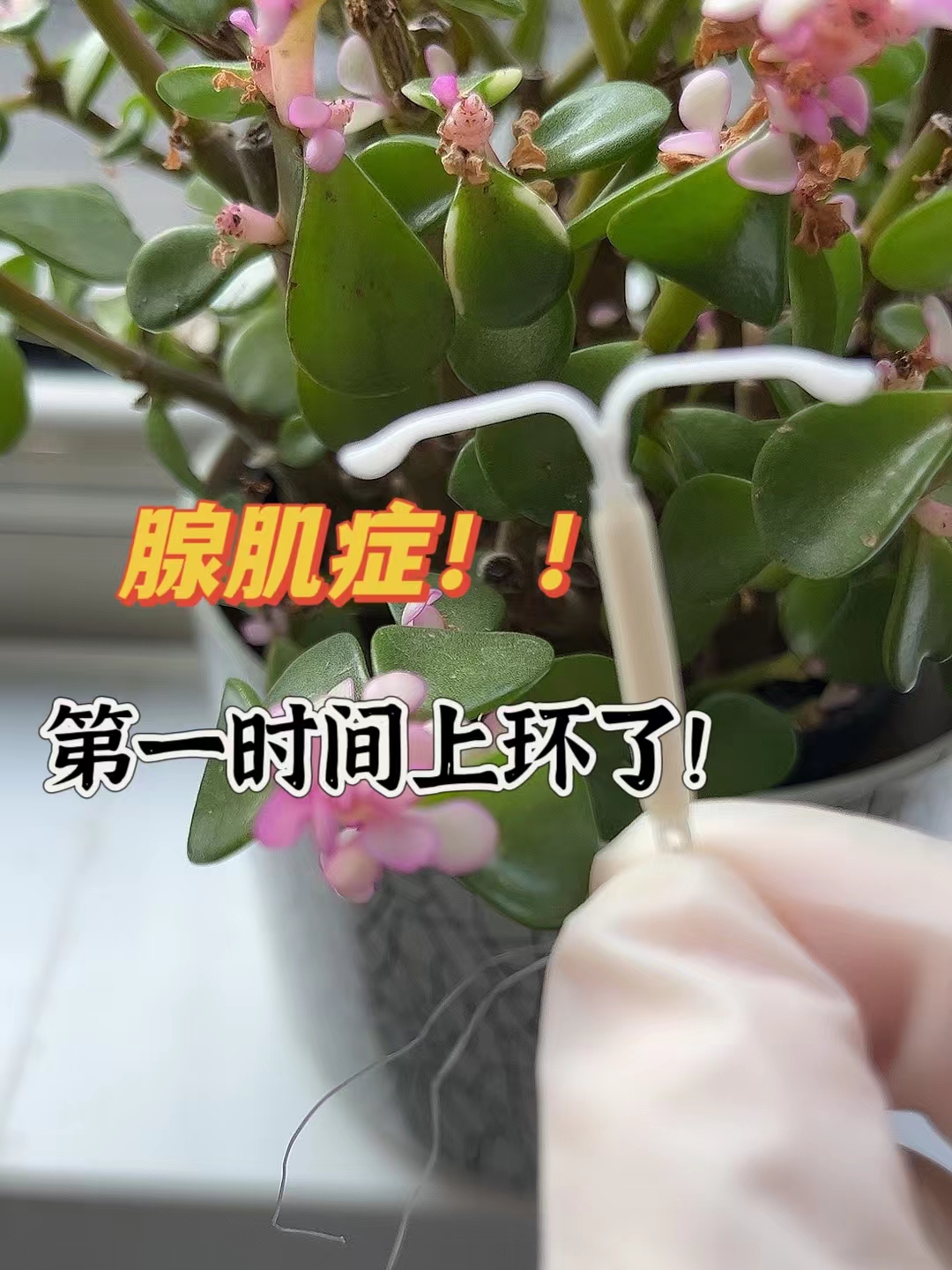 曼月乐环跟普通环的区别在于曼月乐环里面有j素可以缓慢释放掖怂
