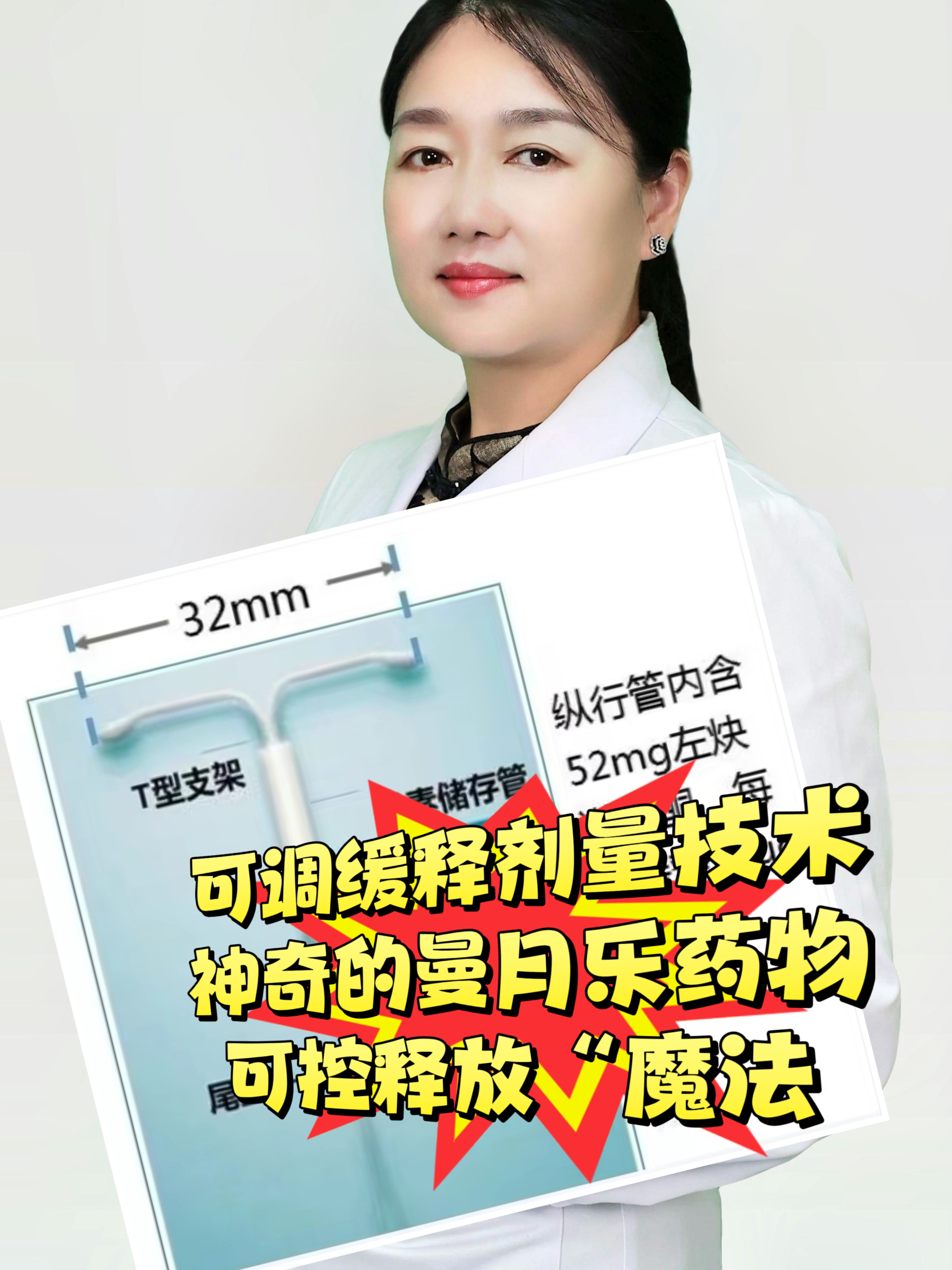 曼月乐可调缓释剂量治疗腺肌症的神奇魔法 曼月乐通过宫内缓释的方式