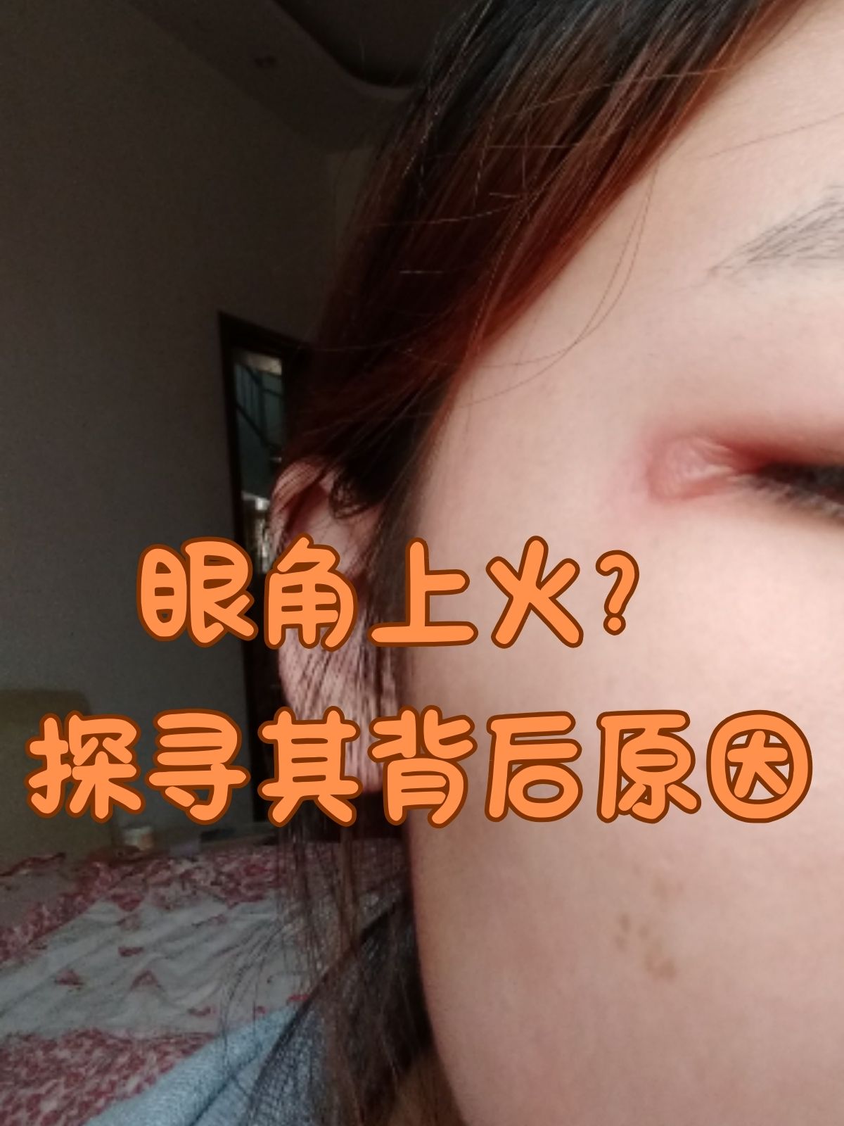 女生眼睛上火肿的图片图片