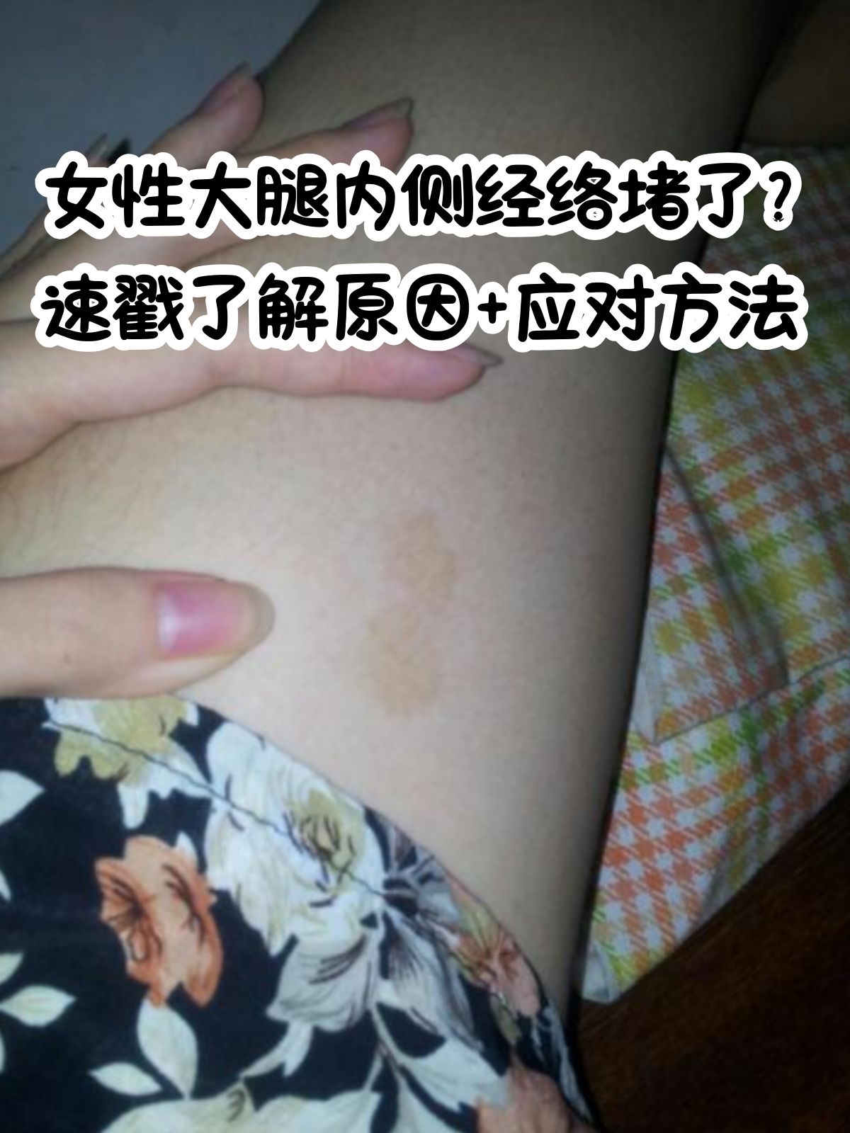 女性大腿内侧经络堵了?
