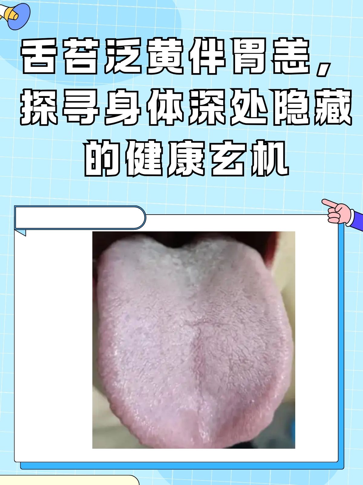 为什么舌苔发黄