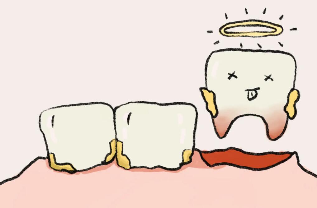 牙齿脱落是一种常见的口腔问题,可能由多种因素引起