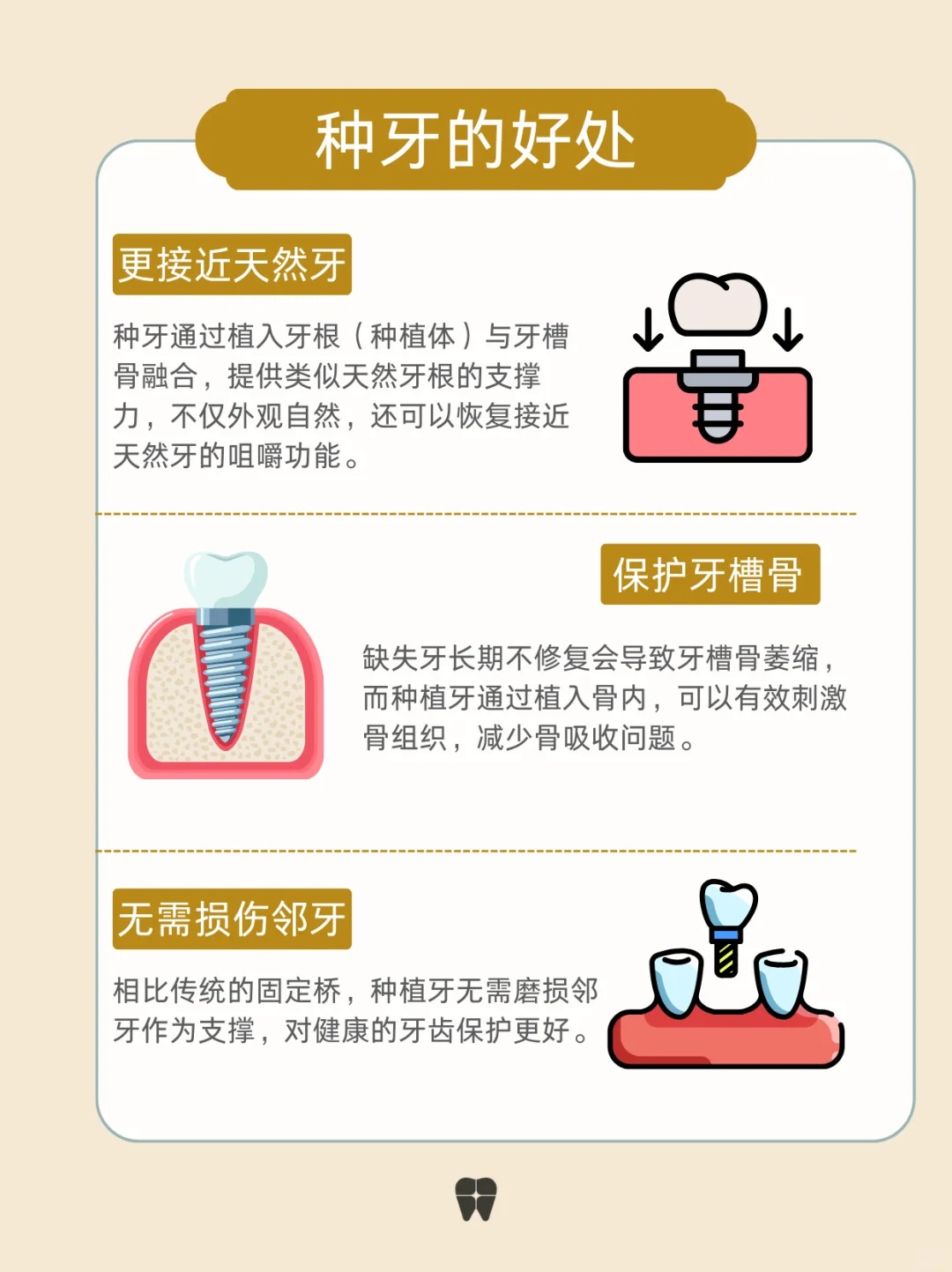 种牙不仅能恢复功能,还能保持自然美观,保护邻牙,一次种牙,长久受 !!