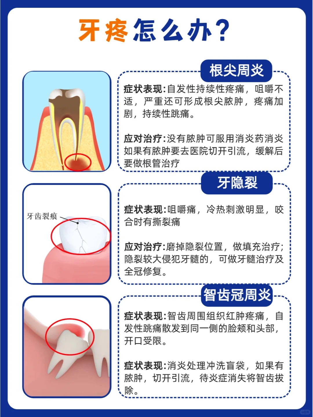 上火为什么牙疼