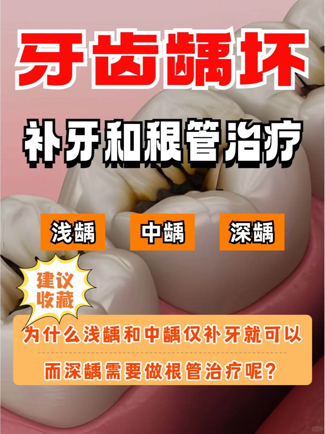 为什么蛀牙总是晚上疼百科在线