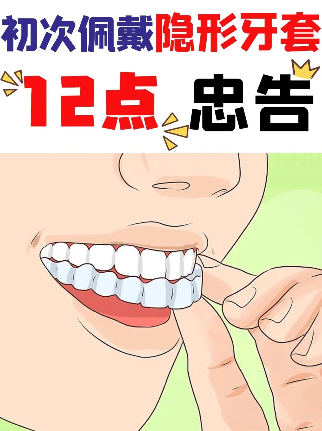 赶紧码隐形矫治器动画隐形矫正卡通隐形矫正 卡通牙齿矫正动画图片
