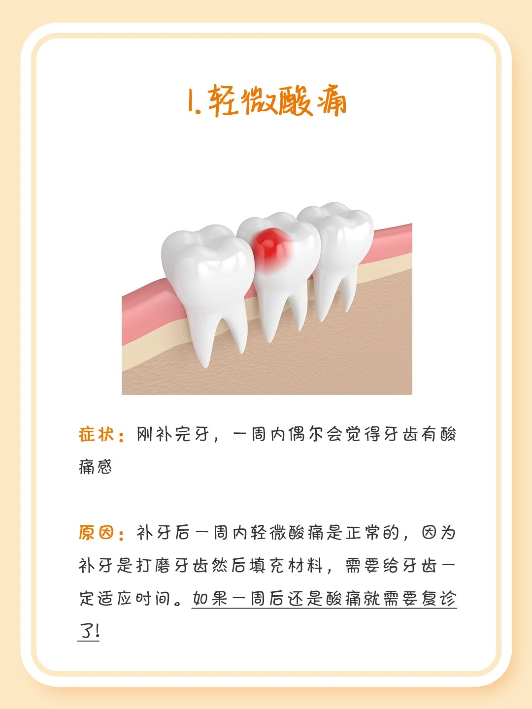 补牙必看!如何判断你的牙补得好不好?