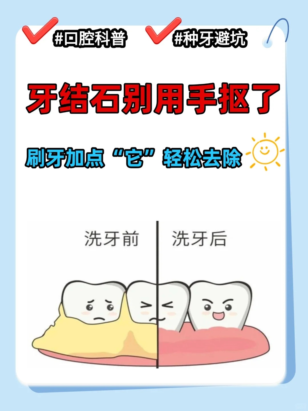 牙结石别用手抠了 刷牙加点"它"轻松去除 发现牙结石的你,千万不要用