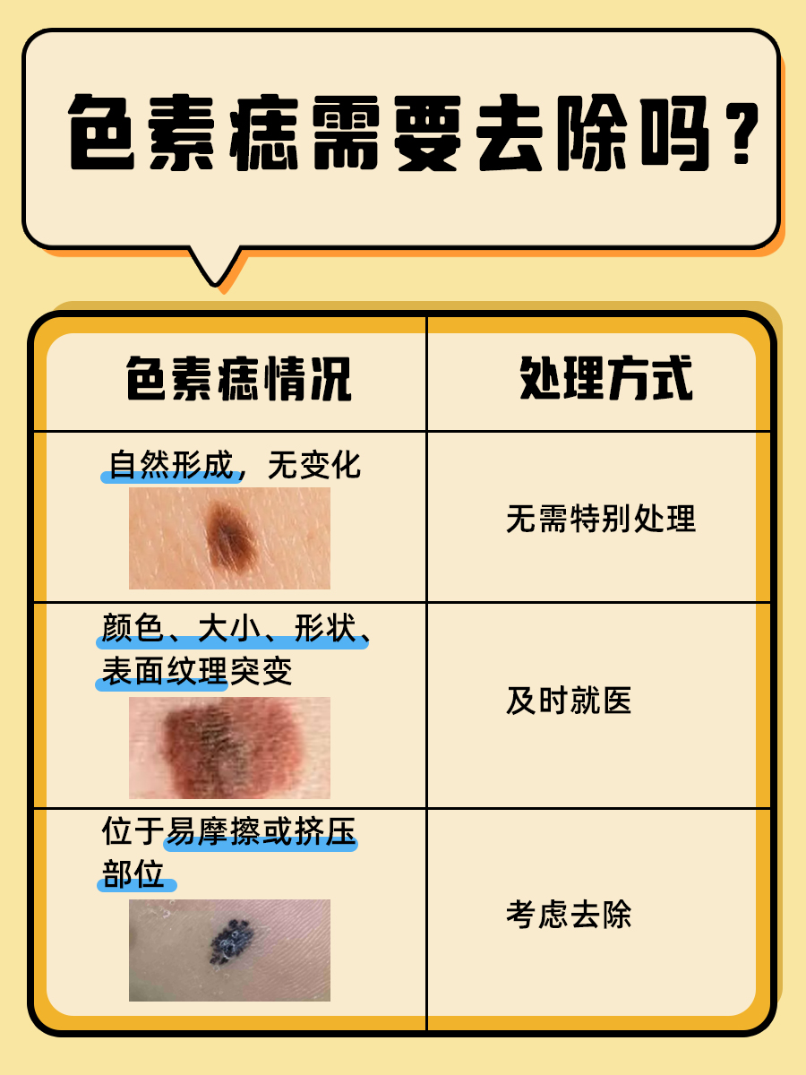 色素痣是皮肤细胞在局部聚集形成的,大多数情况下是良性的,对人体健康