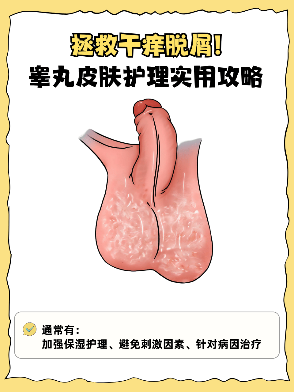 睾丸皮肤干燥脱屑背后藏着多种原因,处理不当可能加重问题