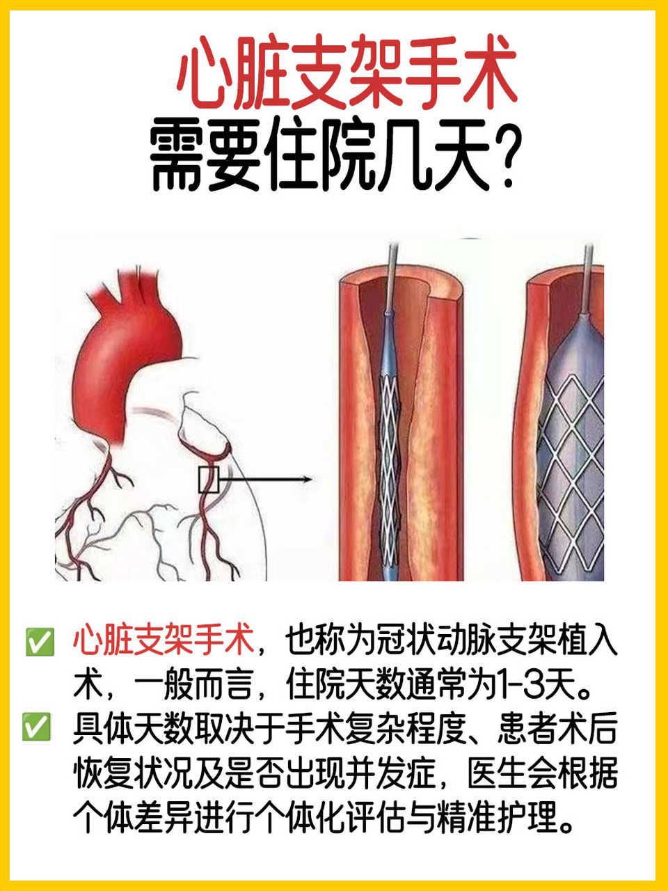 冠脉支架图片