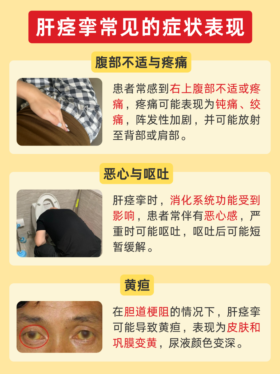 肝痉挛是指肝脏区域发生的突发性痉挛性疼痛,通常涉及肝脏本身及其