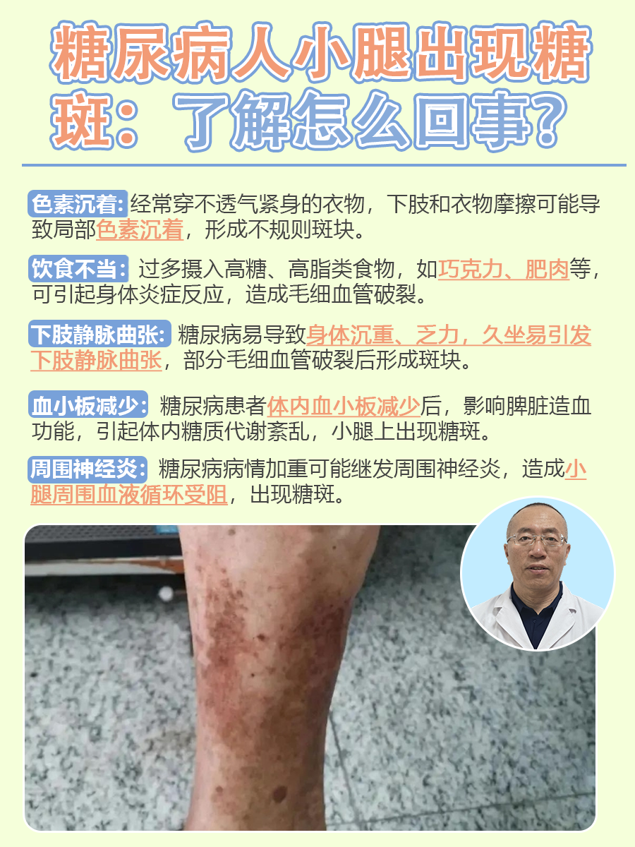 糖尿病并发症腿部图片