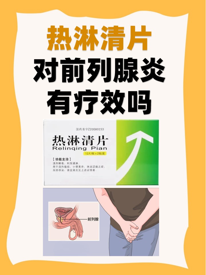 热淋清片可以在前列腺炎的治疗中发挥一定的辅助作用,但并非万能药