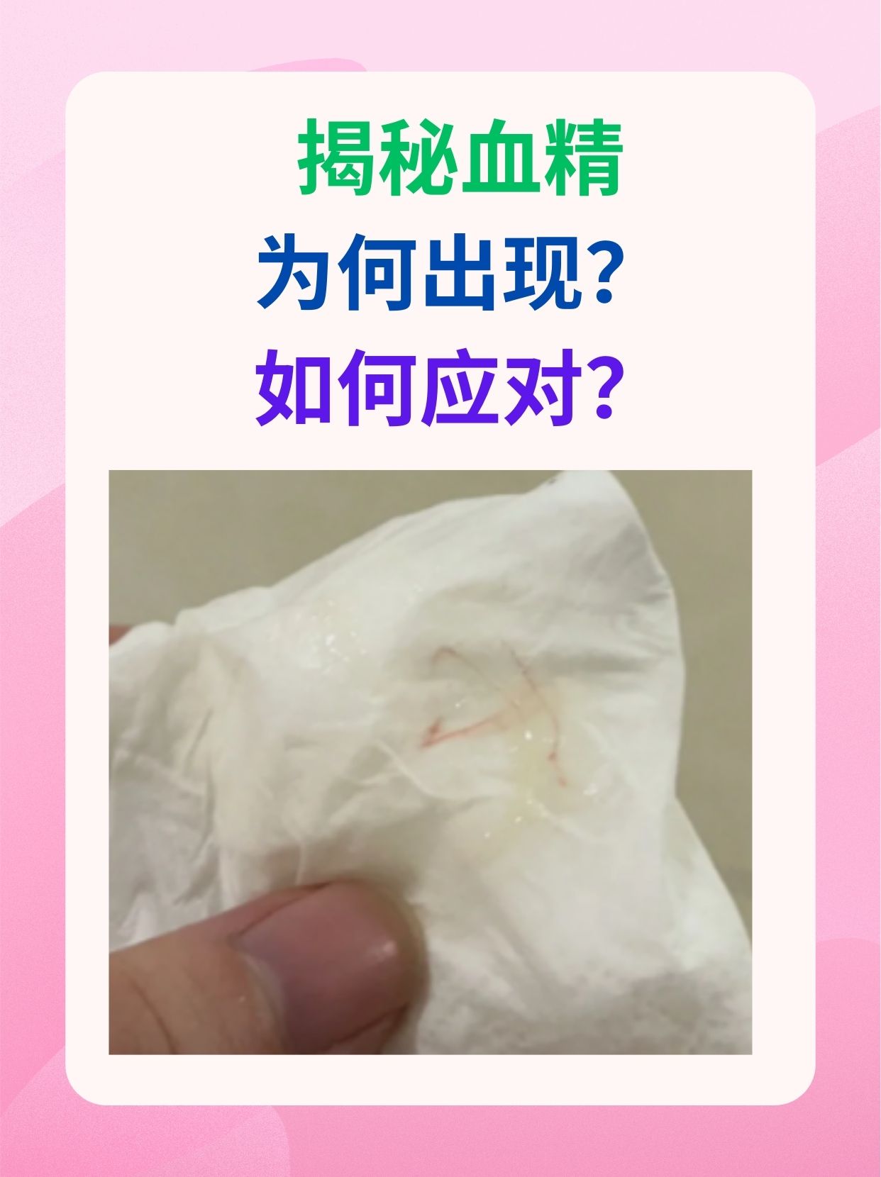 揭秘血精,为何出现?