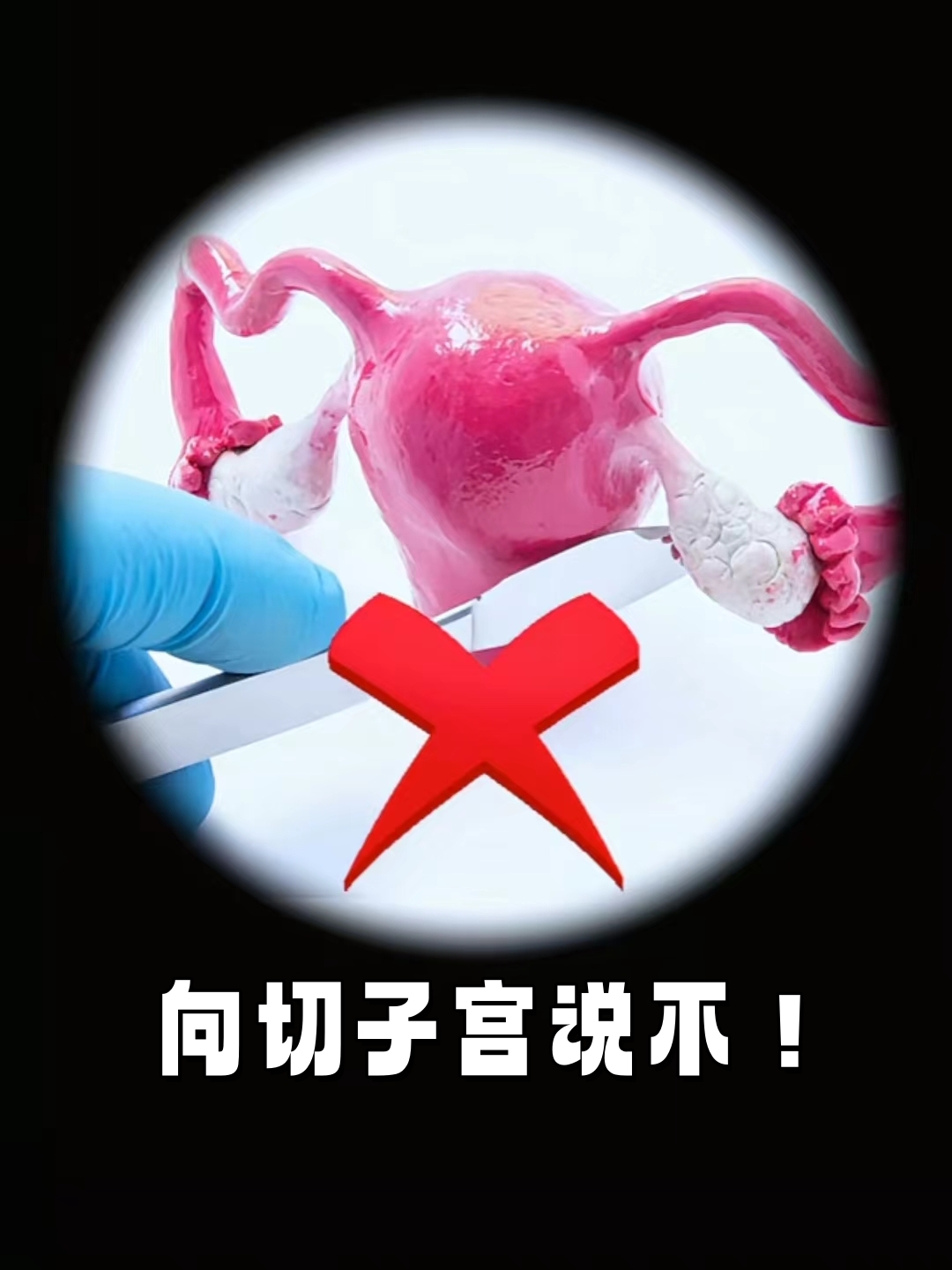 内分泌指挥官 虽然不直接分泌激素 但和卵巢输卵管