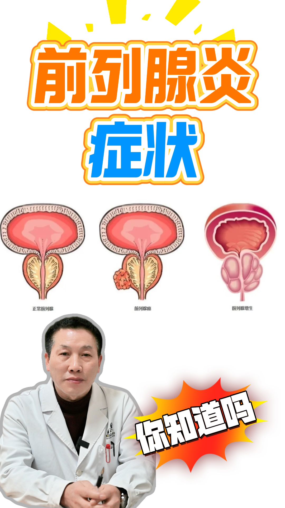 男科疾病尿痛的简单介绍 男科疾病尿痛的简单

先容
（男科尿道痛） 男科