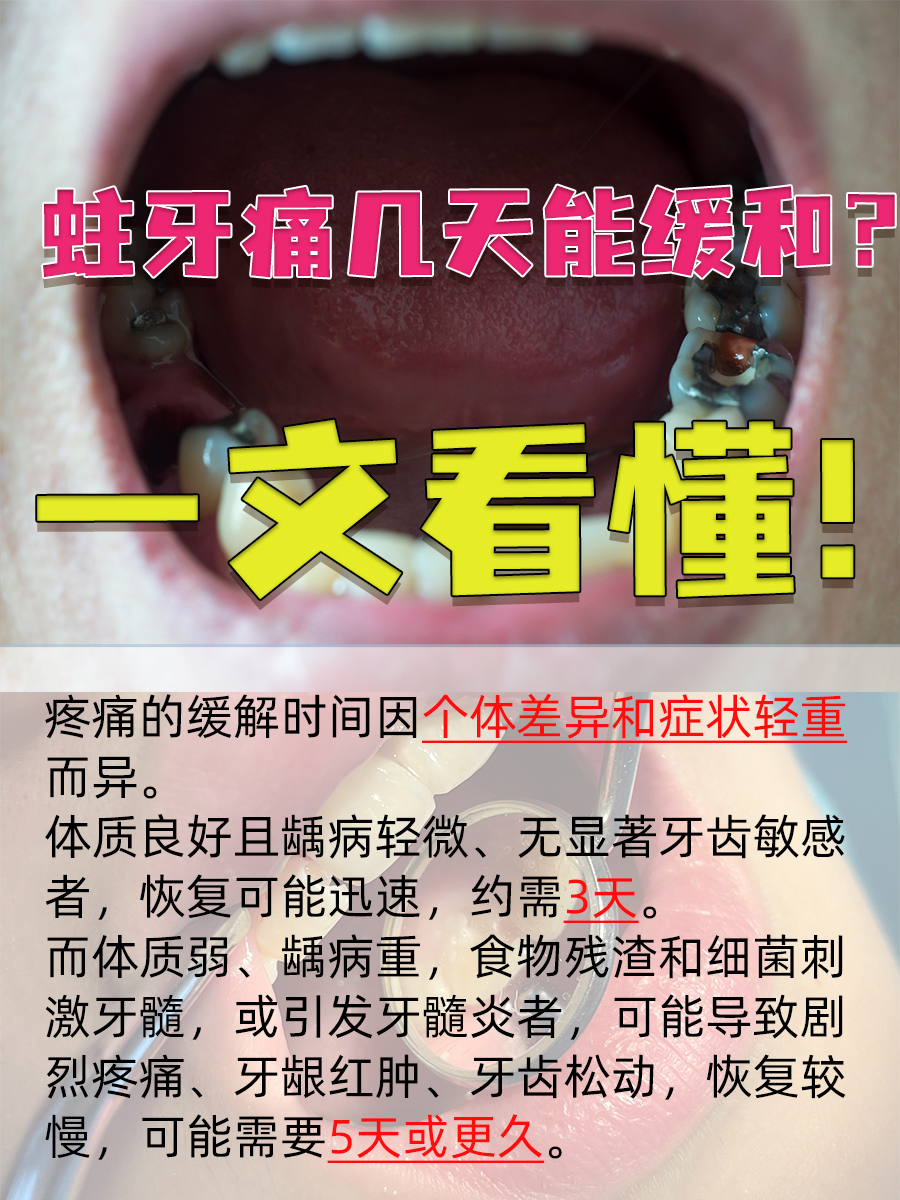 为什么会蛀牙的原因有哪些百科在线 为什么会蛀牙的原因有哪些百科在线