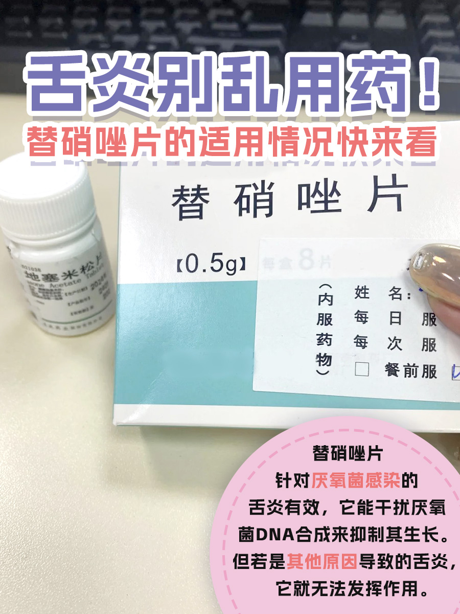 要弄清楚这个问题,我们得先了解舌炎究竟是怎么回事,以及替硝唑片的