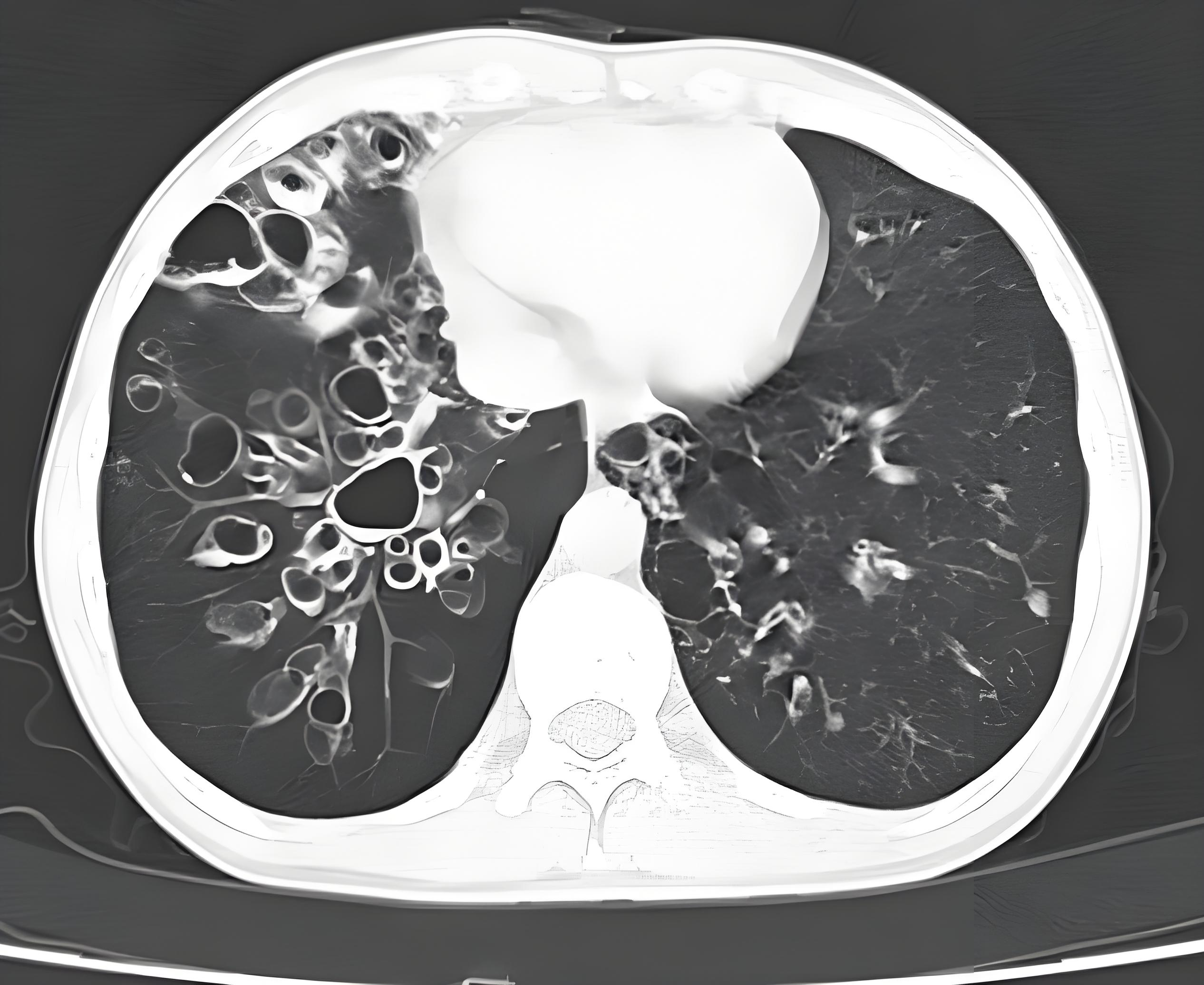 这 5 个习惯保持住,再差的肺也能慢慢改善