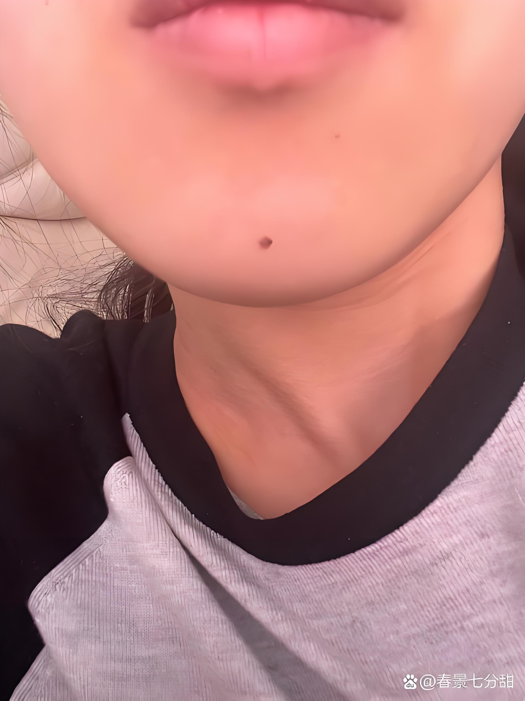 古相法:下巴有痣的人,晚年必有意外之财,但要防小人陷害