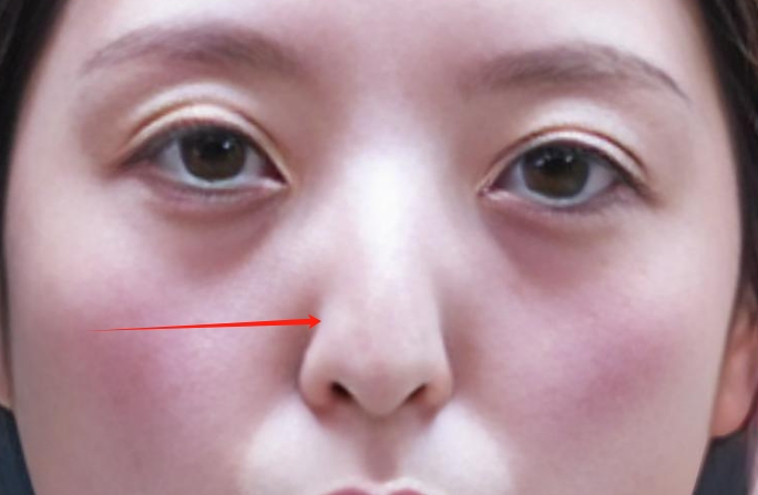 鼻头有肉,心内无毒,大师揭秘:这种鼻相的人,走到哪都能遇贵人