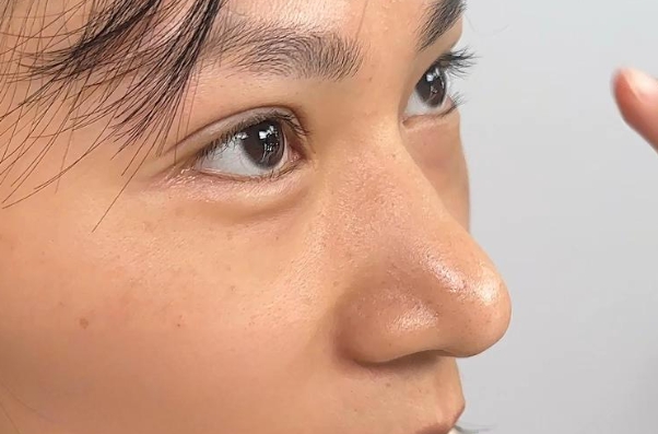 鼻头有肉,心内无毒,大师揭秘:这种鼻相的人,走到哪都能遇贵人