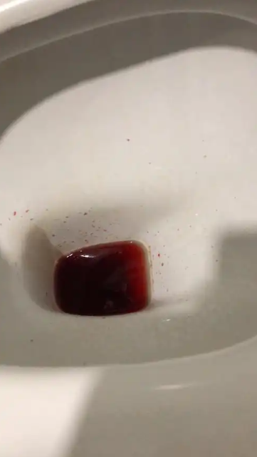 52岁男性前列腺增生吃坦索罗辛,1年突发尿血,医生:你干啥了