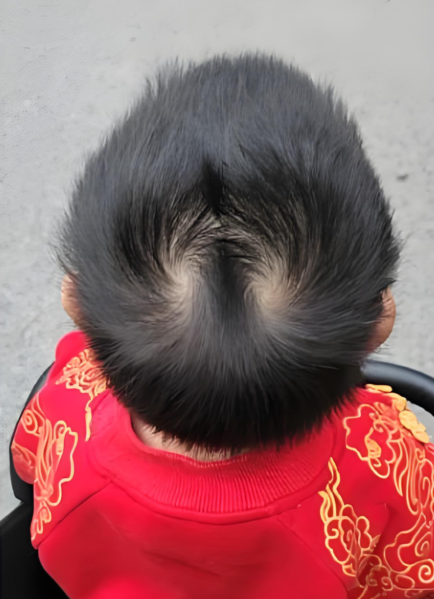 遗传学专家证实:孩子头顶双旋绝非偶然,竟是天赋异禀的重要征象