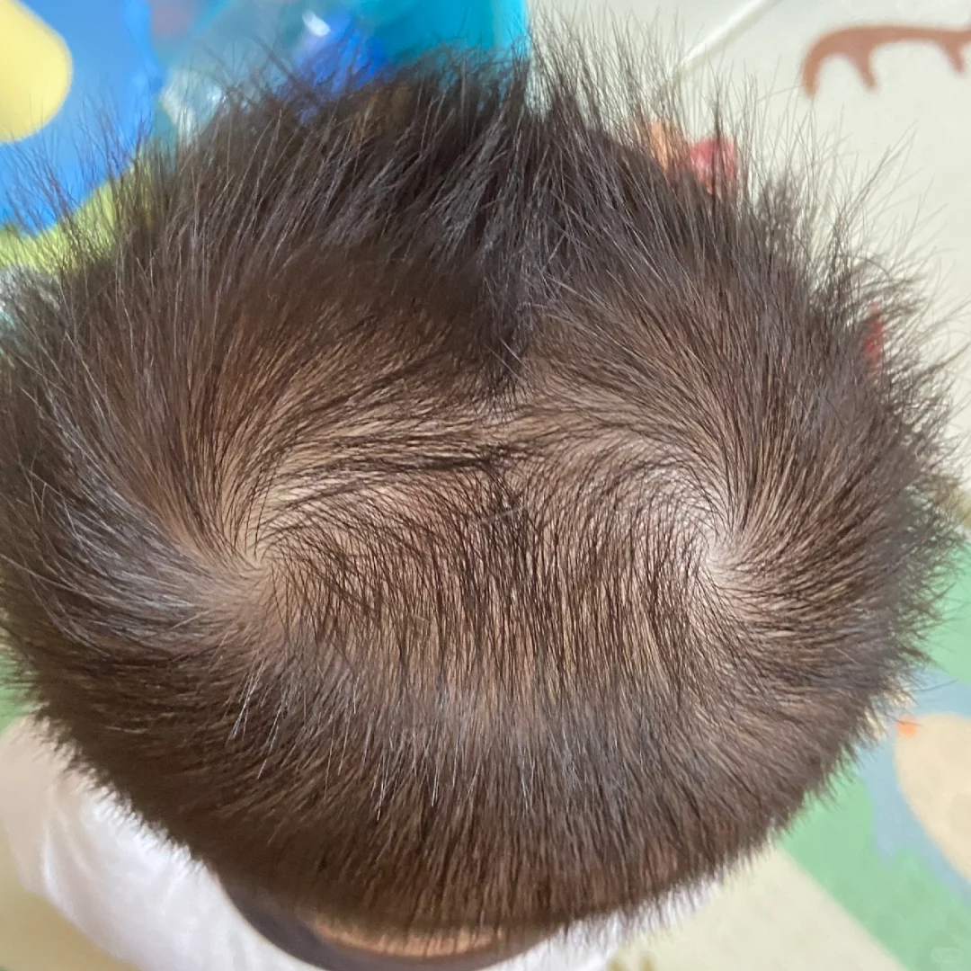 孩子头上有"2个旋",老话说藏乾坤,贵人多还是脾气拧,一看就懂