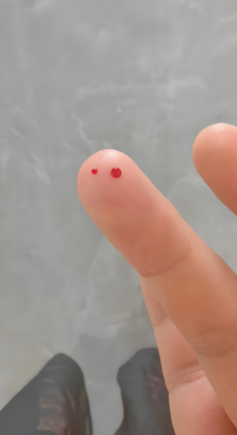 女子入住网红民宿,其妹妹的手被针扎破,担心感染某种病毒,比如hiv,越