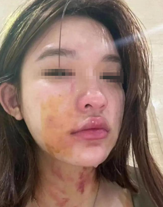 故事:唐山打人案,白衣女孩8个月后现身,向公众袒露其中隐情