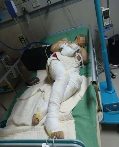 回顾:男子房子遭强拆,与强拆人员发生冲突后,自焚致7人受伤