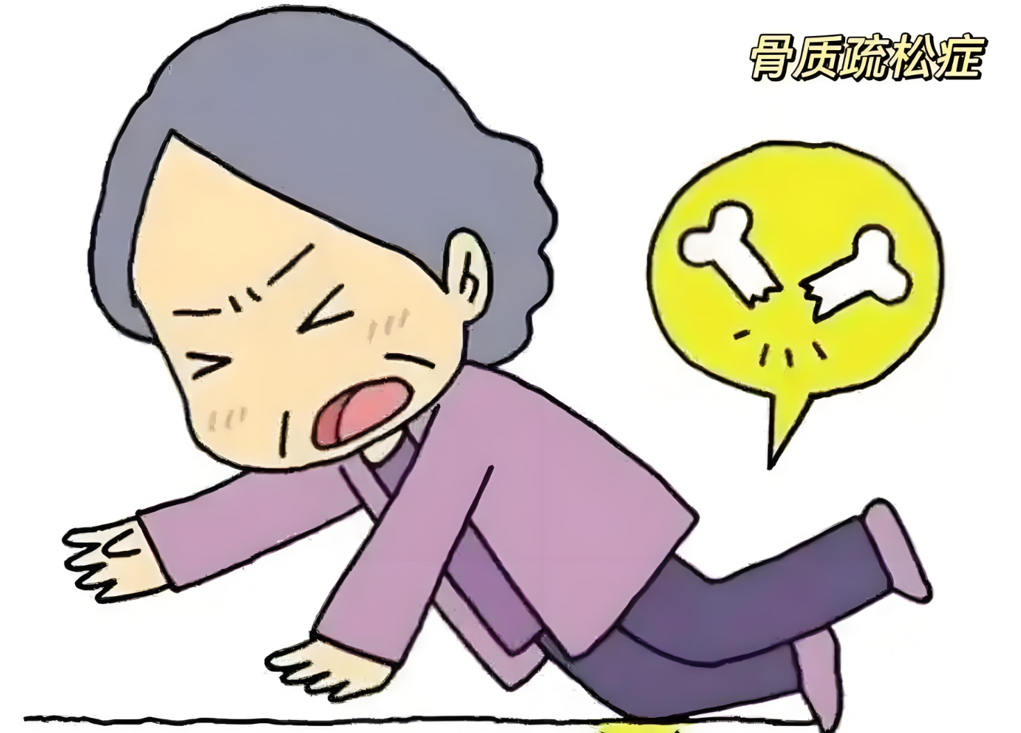 14年,58岁女子骨密度年轻化,问其原因道:我有3个好习惯