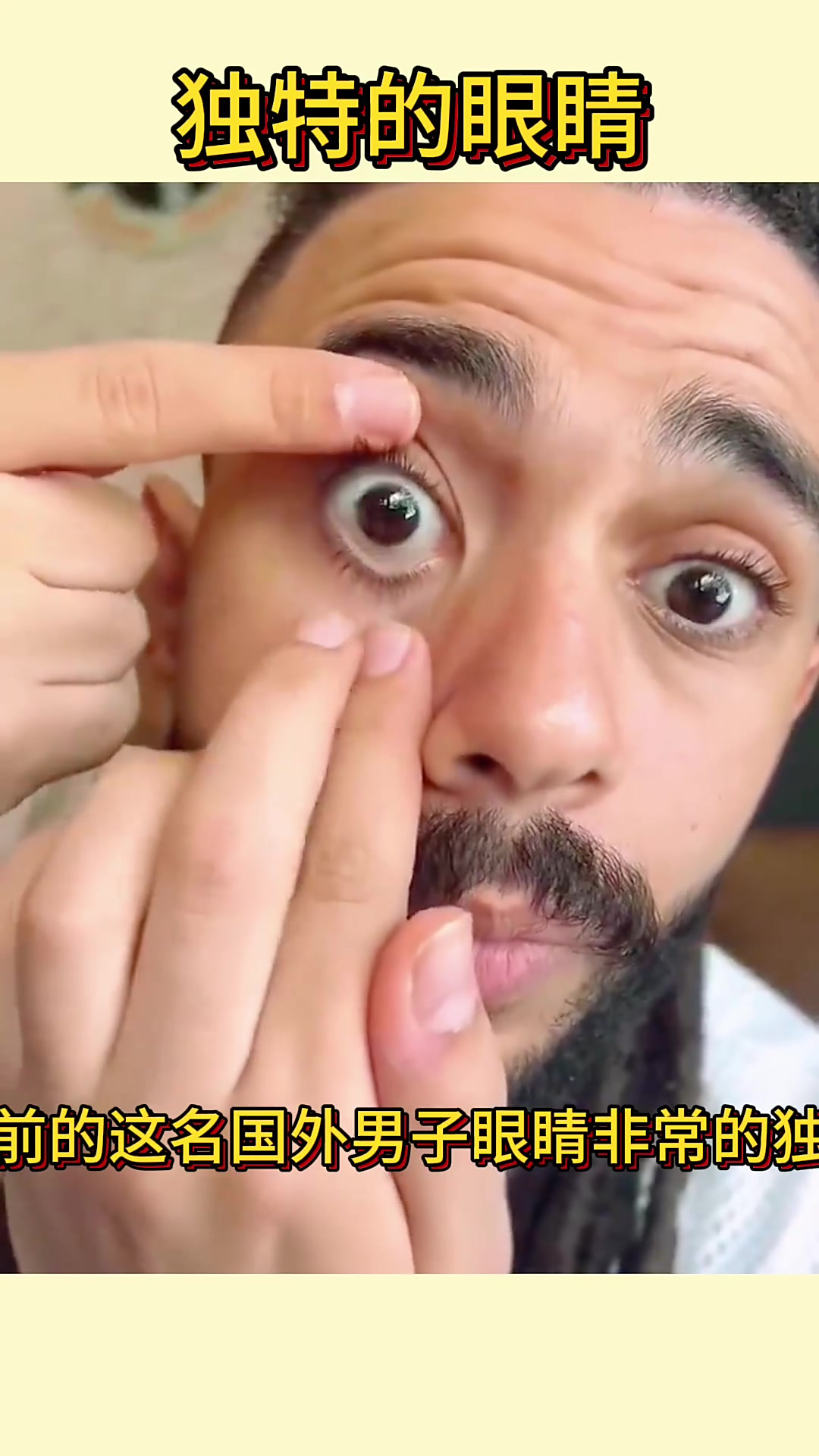 独特男子双瞳孔眼睛:视野广阔,人人都不同的奇特之处