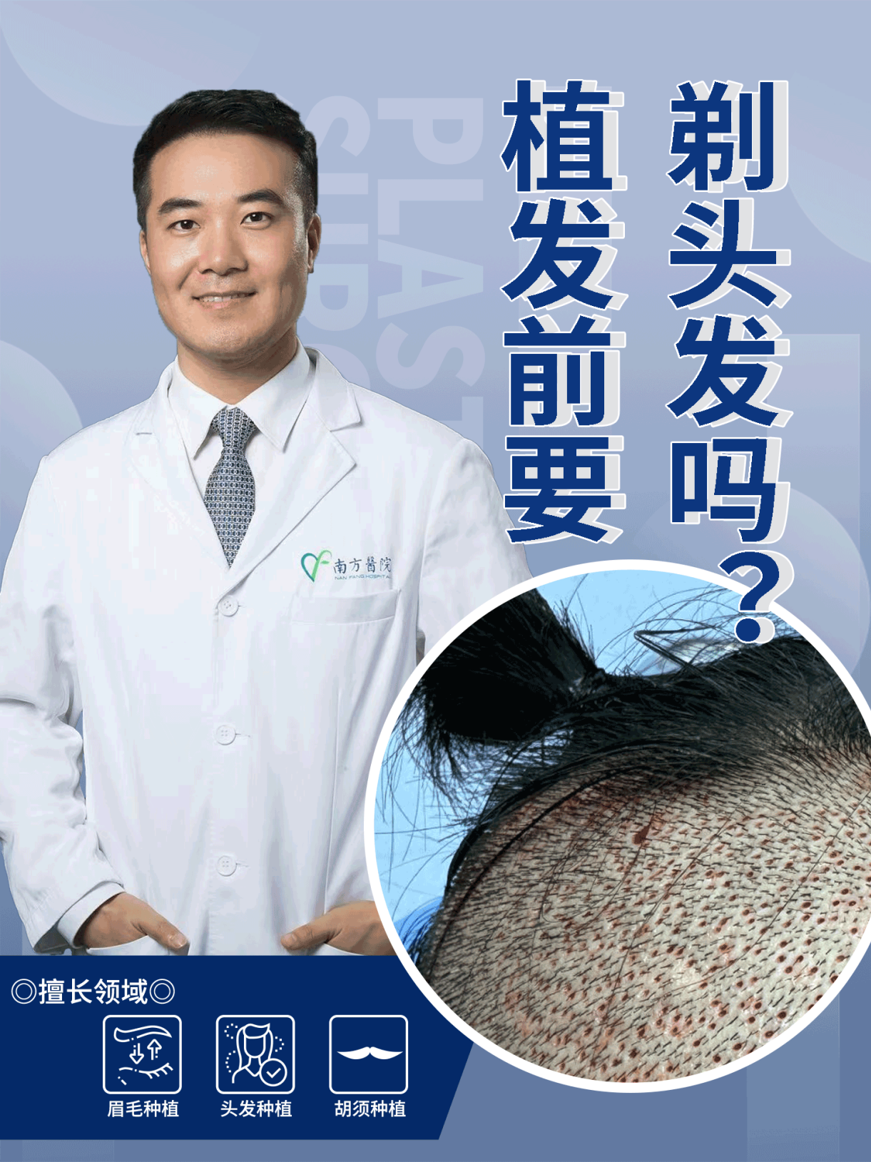 临平植发(杭州植发的价格一般多少钱)