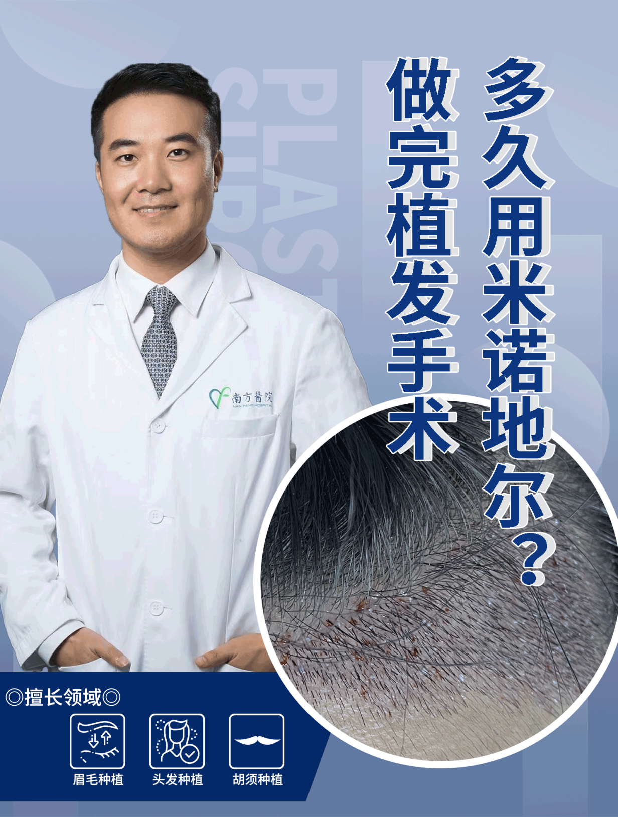 腋毛可植发吗(植发可以把腋毛植到头皮上吗)