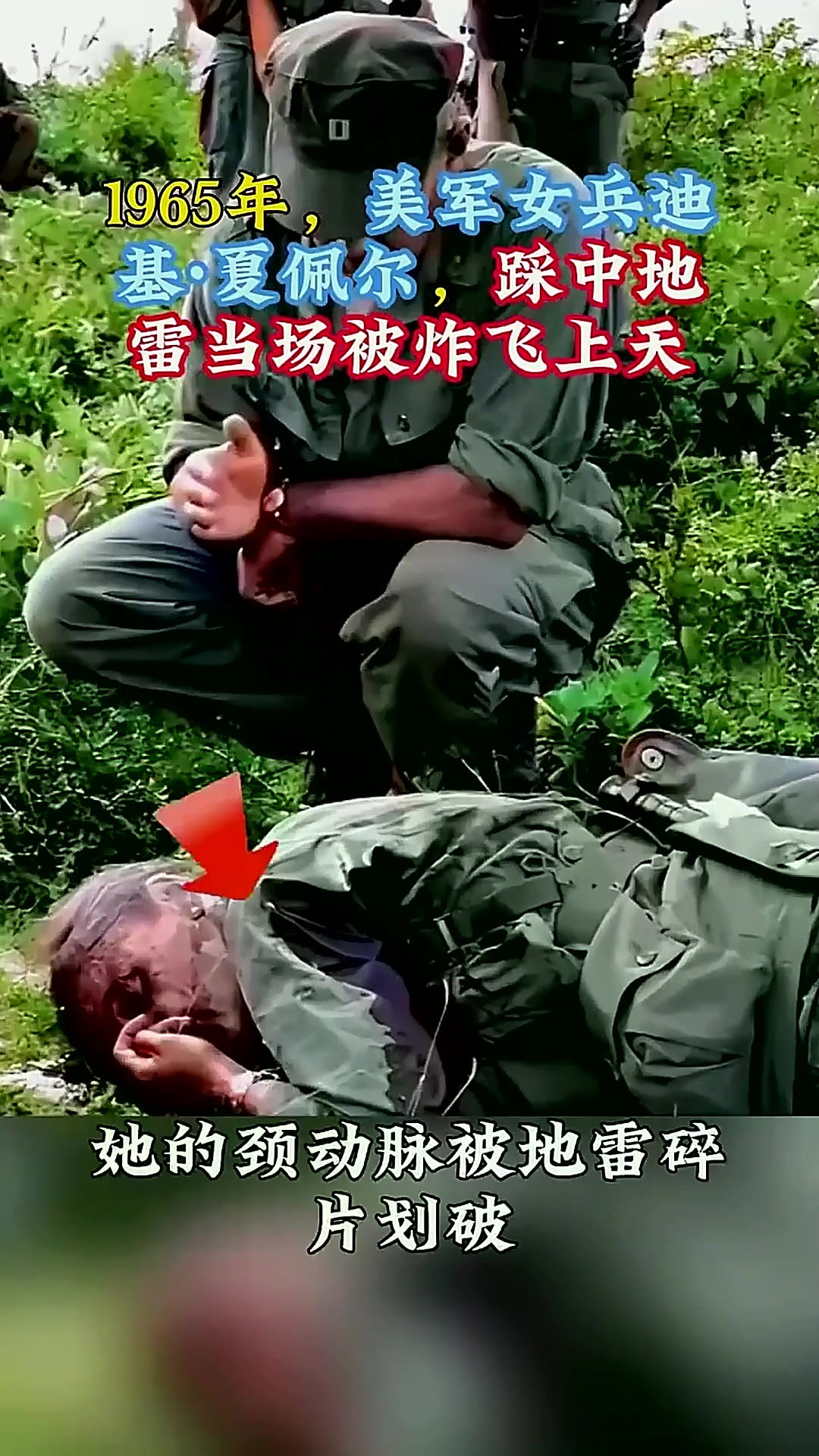 1965年,美军女兵迪基·夏佩尔,踩中地雷当场被炸飞上天