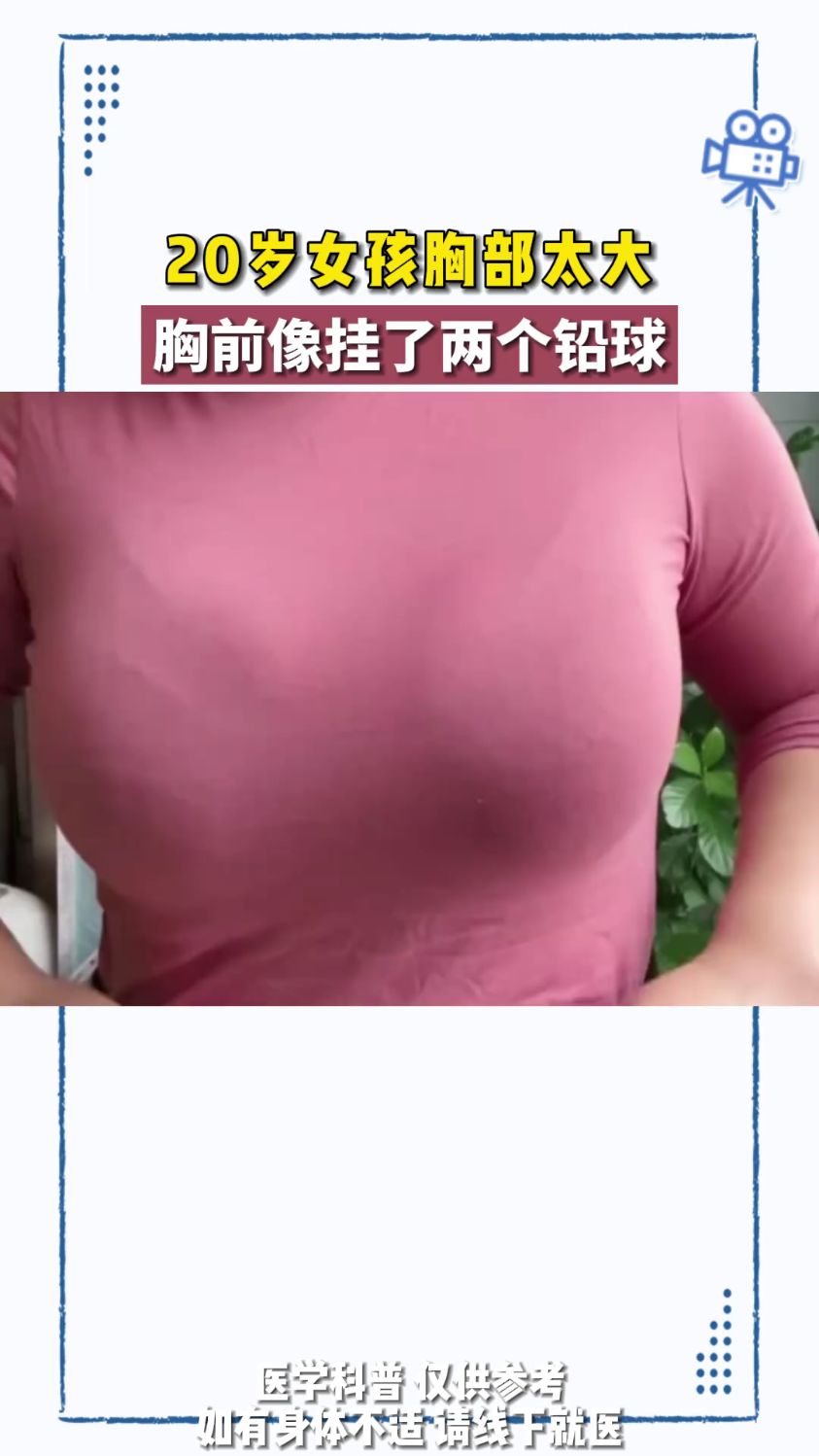 20岁女孩感觉像胸前挂了两个铅球