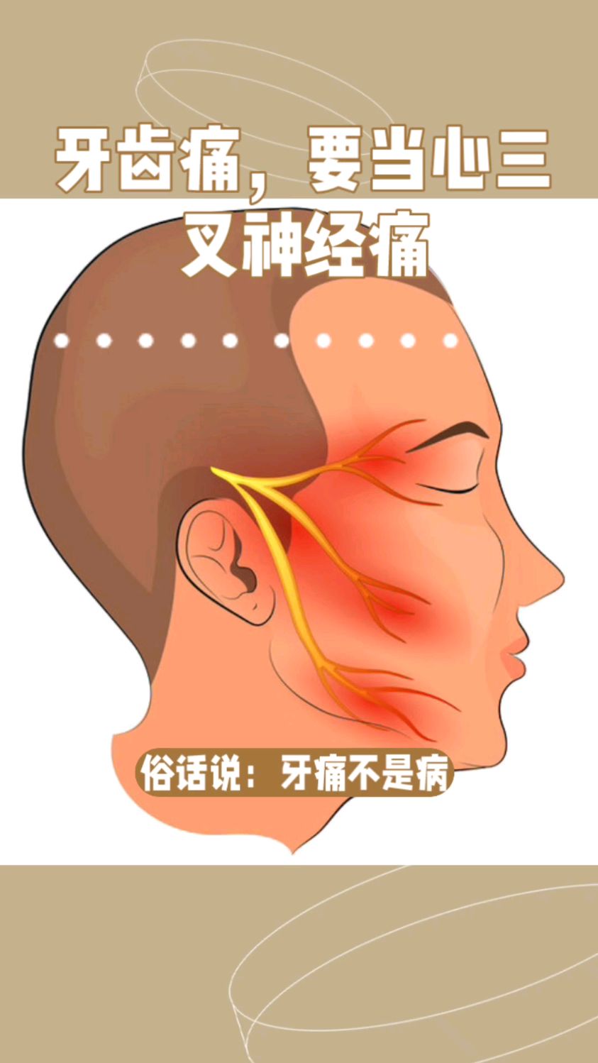 三叉神经痛的症状图片